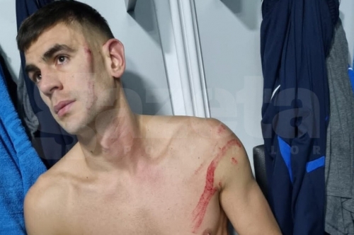 Igor Armaș a fost la un pas de o traumă gravă la cap în meciul din Superliga României (video)